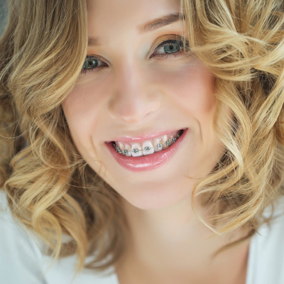 Fort Wayne Dentists | Sleep Apnea, Dental Cleanings and Dental Bridges