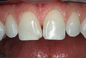 Fort Wayne Dentists | Dental Fillings, Periodontal Treatment and Dental Lab
